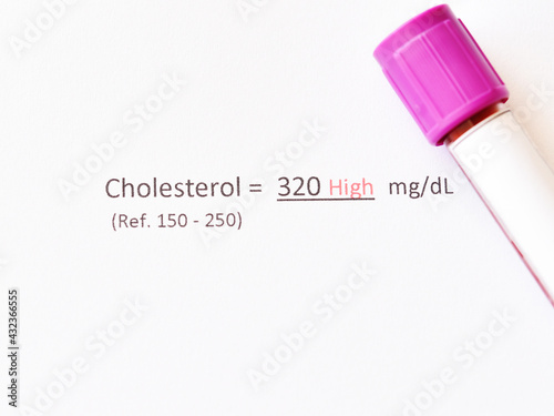 Blood sample tube with abnormal high cholesterol test result