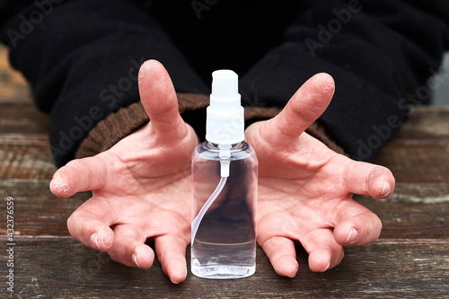 Fotografija dry skin on hands