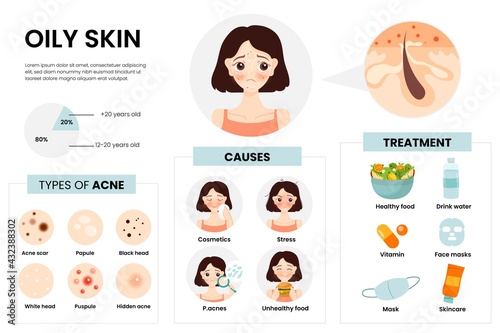 Flat Hand Drawn Oily Skin Problems Infographic