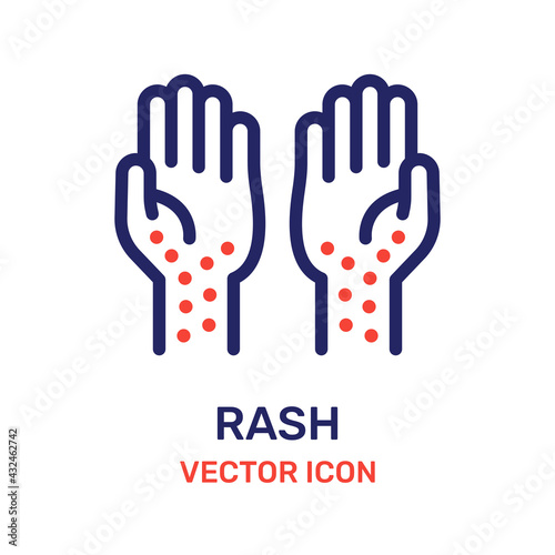 Hand rash icon vector. Allergy icon 