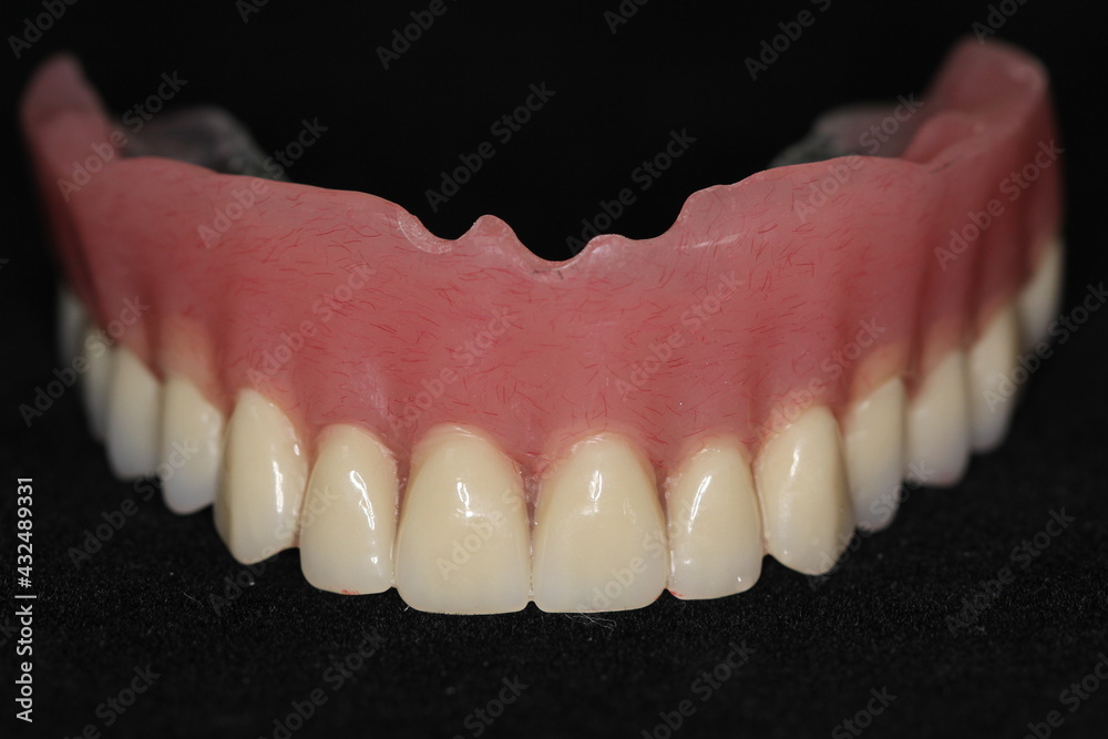 Denture full mount for patient Denture full mount for patient