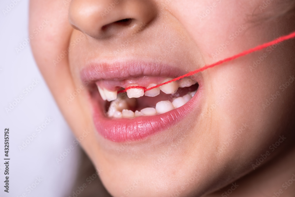 Fototapeta premium Little girl pulling her loose tooth.