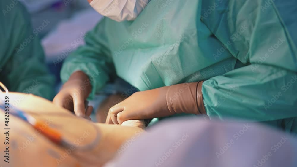 Body lifting. Patient's body during plastic surgery. Doctor in safety gloves performing a medical procedure in operating room. Close-up. Body lifting. Patient's body during plastic surgery. Doctor in safety gloves performing a medical procedure in operating room. Close-up.