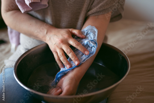Woman treating burns on her hand, applying cold water on injured skin