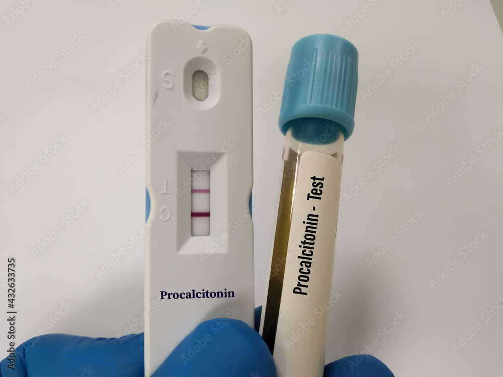 Blood sample tube and device or cassette for Procalcitonin test