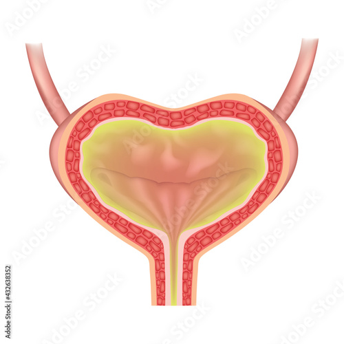 overactive bladder. Detrusor contraction. Vector illustration.