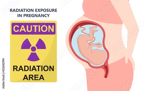 Film badge TLD OSL RPL pocket device dose Physics Ionising monitor risk working x-ray x ray beta gamma safe MRI Prevent level detect lead aprons health care Effect cancer Occupation beam Shield danger