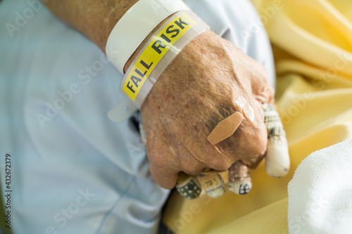 A hospital patient wearing a fall risk bracelet and fingers separation pad anti-bedsore elder bedridden patients in the patient's hand.