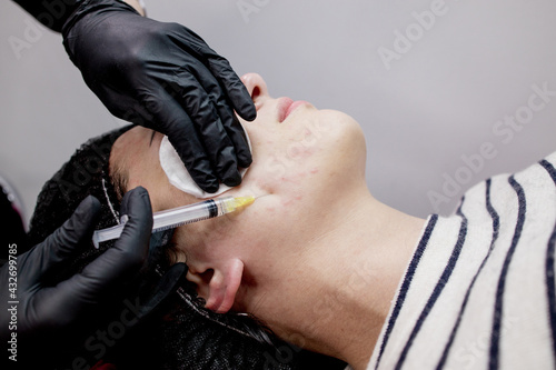 Cosmetologist doctor is making multiple injections biorevitalization with hyaluronic acid in woman face skin, closeup. Woman on the procedure of mesotherapy injection