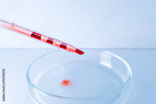 Medical laboratory. The blood from the pipette is poured into an empty Petri dish on a blue background. Laboratory tests.