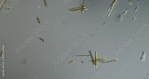 various diatoms from a river photo