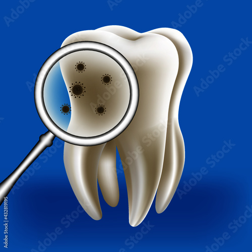 There are stains on the teeth, yellow teeth with dark spots, 3d illustration