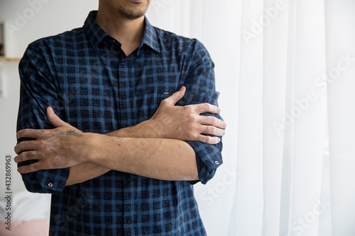 man hugs himself blue shirt hands vitiligo