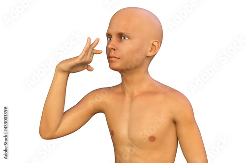 A boy with Sydenham's chorea and involuntary movements of a hand, 3D illustration photo