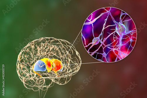 Dorsal striatum in the brain and closeup view of its neurons, 3D illustration photo