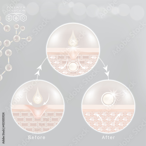 Hyaluronic acid before and after skin solutions ad, white collagen serum drops with cosmetic advertising background ready to use, illustration vector.