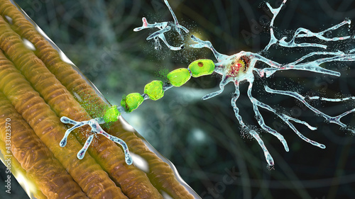Degradation of motor neurons, conceptual 3D illustration photo