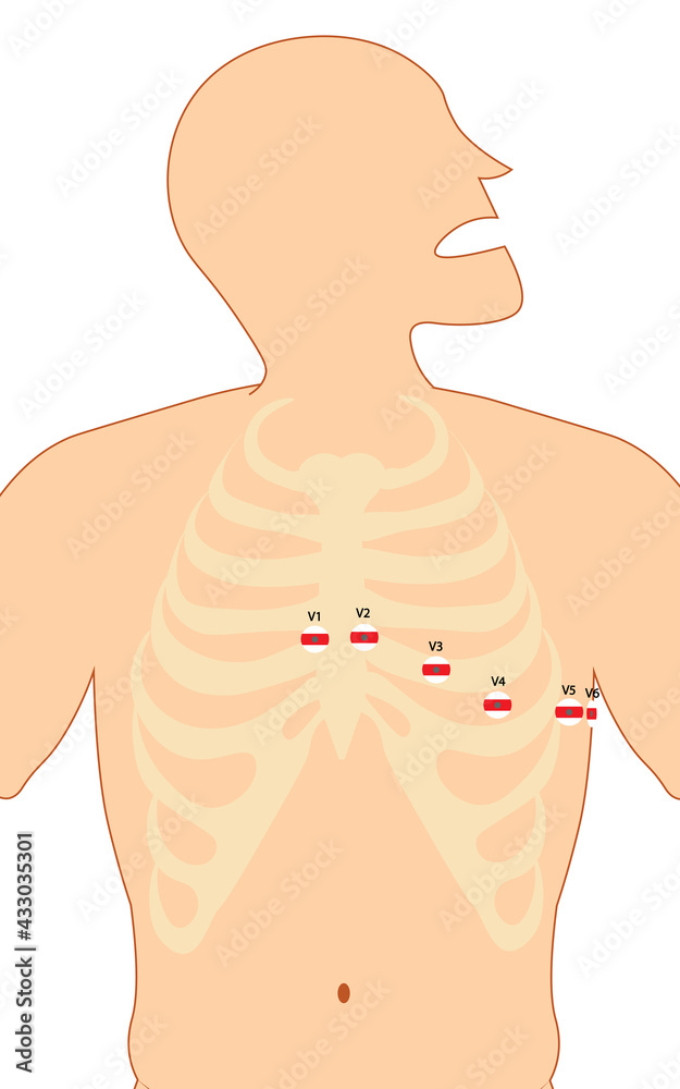 ECG (Electrocardiography) 12lead Precordial lead placement Stock Illustration Adobe Stock