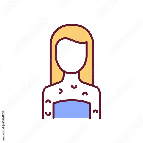 Systemic skin rashes RGB color icon. Contagious infectious disease. Measles in pregnancy. Insect bites. Allergies, infections. Childhood illnesses. Maternity rubella. Isolated vector illustration