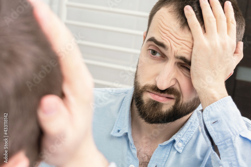 Wallpaper Mural Man with a alcohol withdrawal syndrome and a headache looks in the mirror in the morning, portrait, close-up Torontodigital.ca