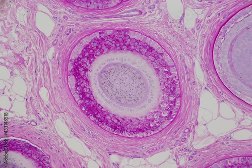 Bild auf Leinwand Scalp hair shaft with brown pigment flecks in the center of a bright pink follicle which is surrounded by fat cells and connective tissue