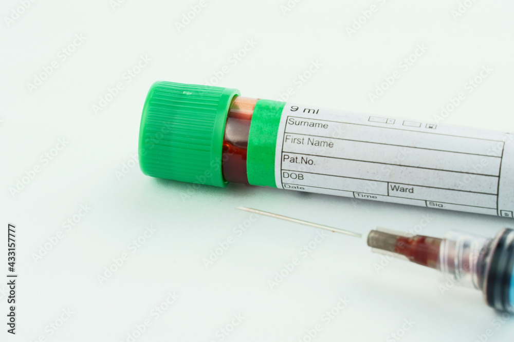 Vacuum tube for collection and blood samples on white background..Transparent with green cap and a syringe. Label to identify the data. Selective focus. Vacuum tube for collection and blood samples on white background..Transparent with green cap and a syringe. Label to identify the data. Selective focus.
