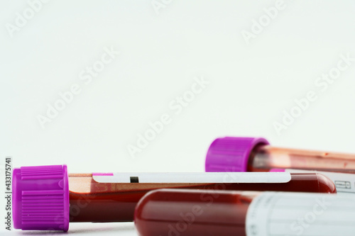 Vacuum tubes for collection and blood samples on white background..Transparent with purple and green lid. Label to identify the data. Selective focus.