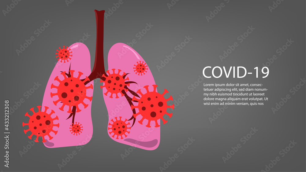 Virus cells in lung. Infected lungs. Coronavirus, COVID-19. 2019-nCoV ...