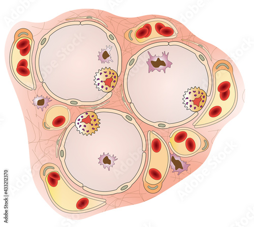 Alveoli of a mammalian lung to show gas exchange surface, alveoli macrophages, surfactant cells and blood capillaries. photo