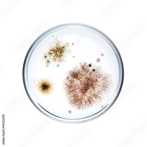 Obraz na plátně Different types of bacterial colonies in petri dish over white background