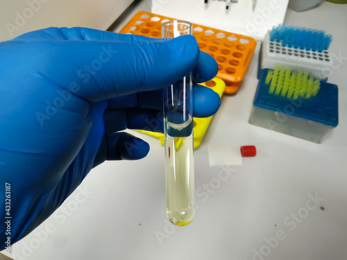 Biochemist hold Cerebrospinal fluid (CSF) sample in a test tube with laboratory background, which is ready for biochemical test (Glucose, Protein, ADA). Closeup. photo