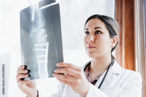 Female doctor looking at bone scan in hospital photo