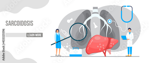 Sarcoidosis awareness month concept vector. Medical event is observed each year during April. Sarcoidosis, involving abnormal collections of inflammatory cells