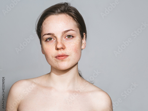 Young beautiful freckles woman face portrait with healthy skin. Gray background.