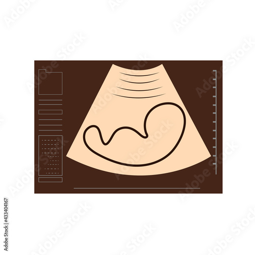 Ultrasonic picture of unborn baby. The Baby silhouette in ultrasound scan. Medical and Health of the baby concept. 