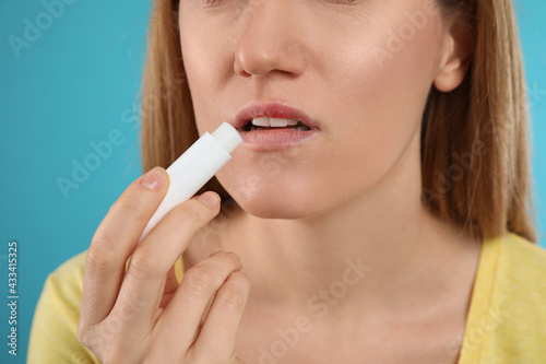 Woman with herpes applying lip balm against light blue background  closeup