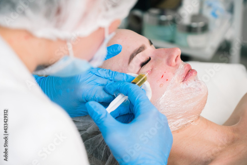 PRP therapy in beauty clinic. Cosmetologist doing injections of blood plasma to womans face to cure problem skin, closeup side view. Treatment of skin in cosmetology for young female.