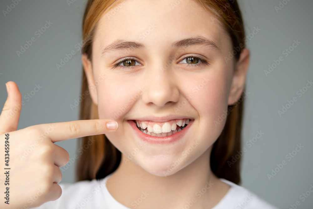 The girl smiles and shows her uneven teeth with a finger. Dental medicine and healthcare The girl smiles and shows her uneven teeth with a finger. Dental medicine and healthcare