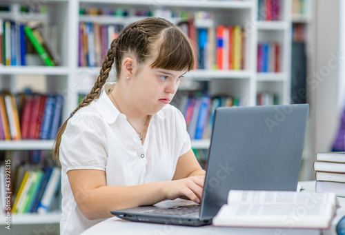 Girl with syndrome down uses a laptop at library. Education for disabled children concept