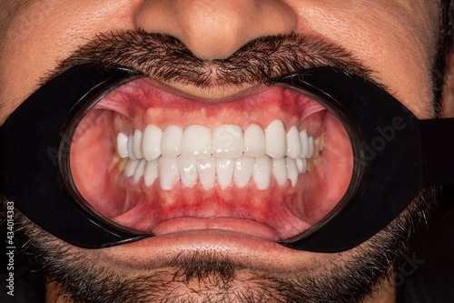 Dentistry men close up smile