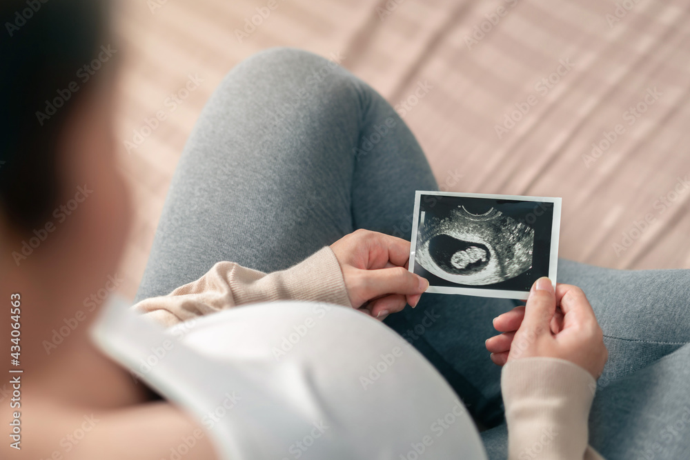 Asian pregnant woman holding ultrasound scan image, Expectation of a