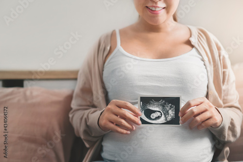 Asian pregnant woman holding ultrasound scan image, Expectation of a child and Maternity prenatal care and woman pregnancy concept.
