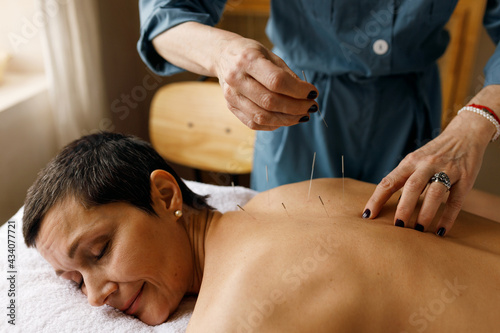 Alternative medicine, treatment, healing and health concept. Indoor shot of joyful short haired mature female lying on massage couch smiling during acupuncture session with professional acupuncturist