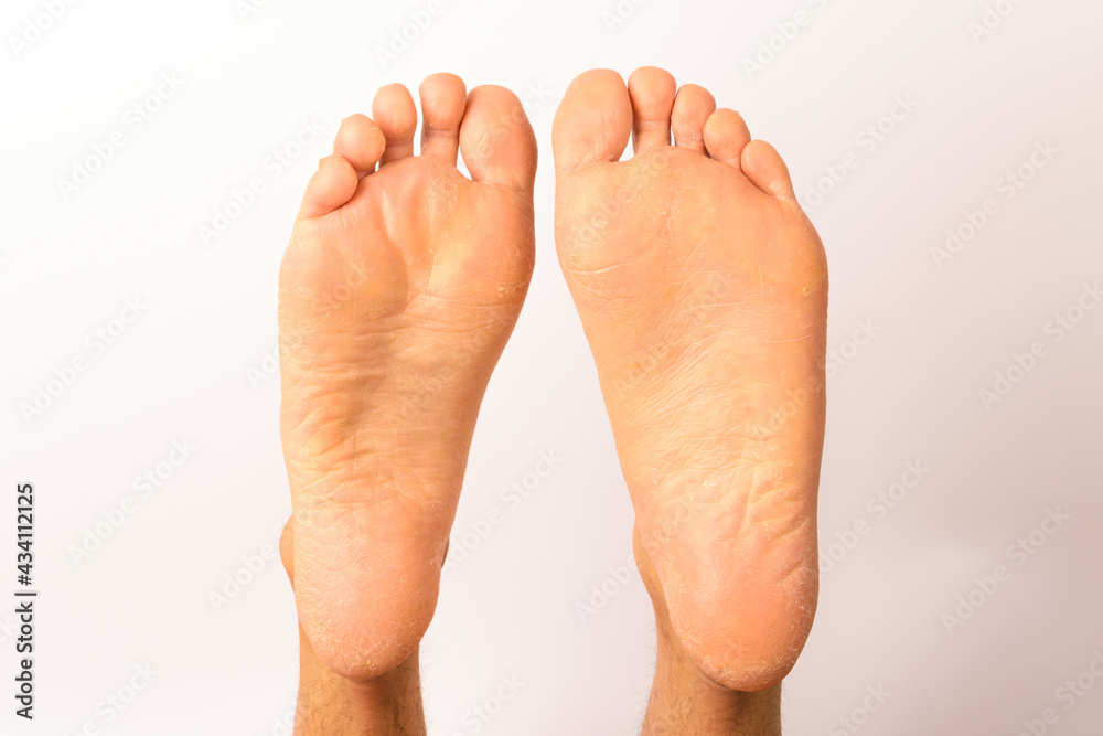 Human foot on white background Human foot on white background