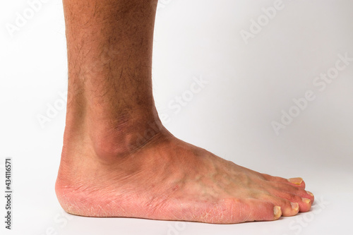 Human feet with white background © 희연 황