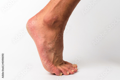 Human feet with white background