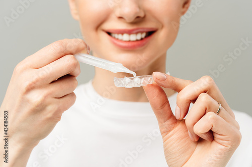 A young woman does a home teeth whitening procedure. Whitening tray with gel photo