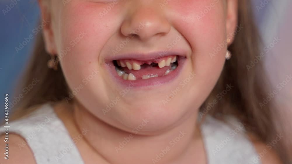 Child without teeth change tooth little girl close up. Beautiful attractive authentic person kid girl posing with open mouth. Healthy white tooths changing. Closeup shot Child without teeth change tooth little girl close up. Beautiful attractive authentic person kid girl posing with open mouth. Healthy white tooths changing. Closeup shot