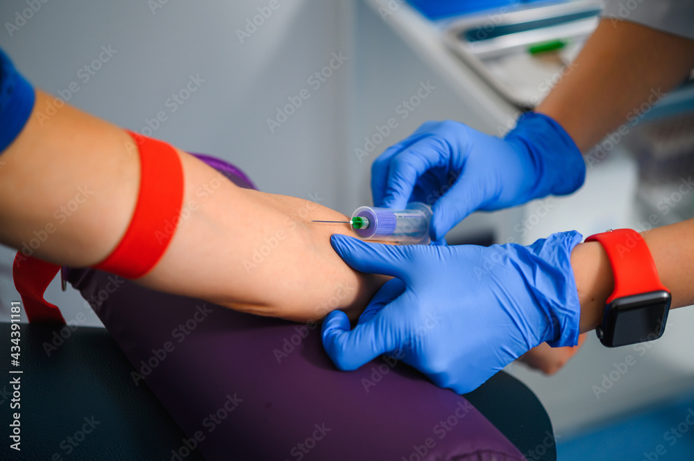 Blood sampling from a vein for research Blood sampling from a vein for research