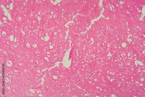 Obraz na plátně Human brain under the microscope
